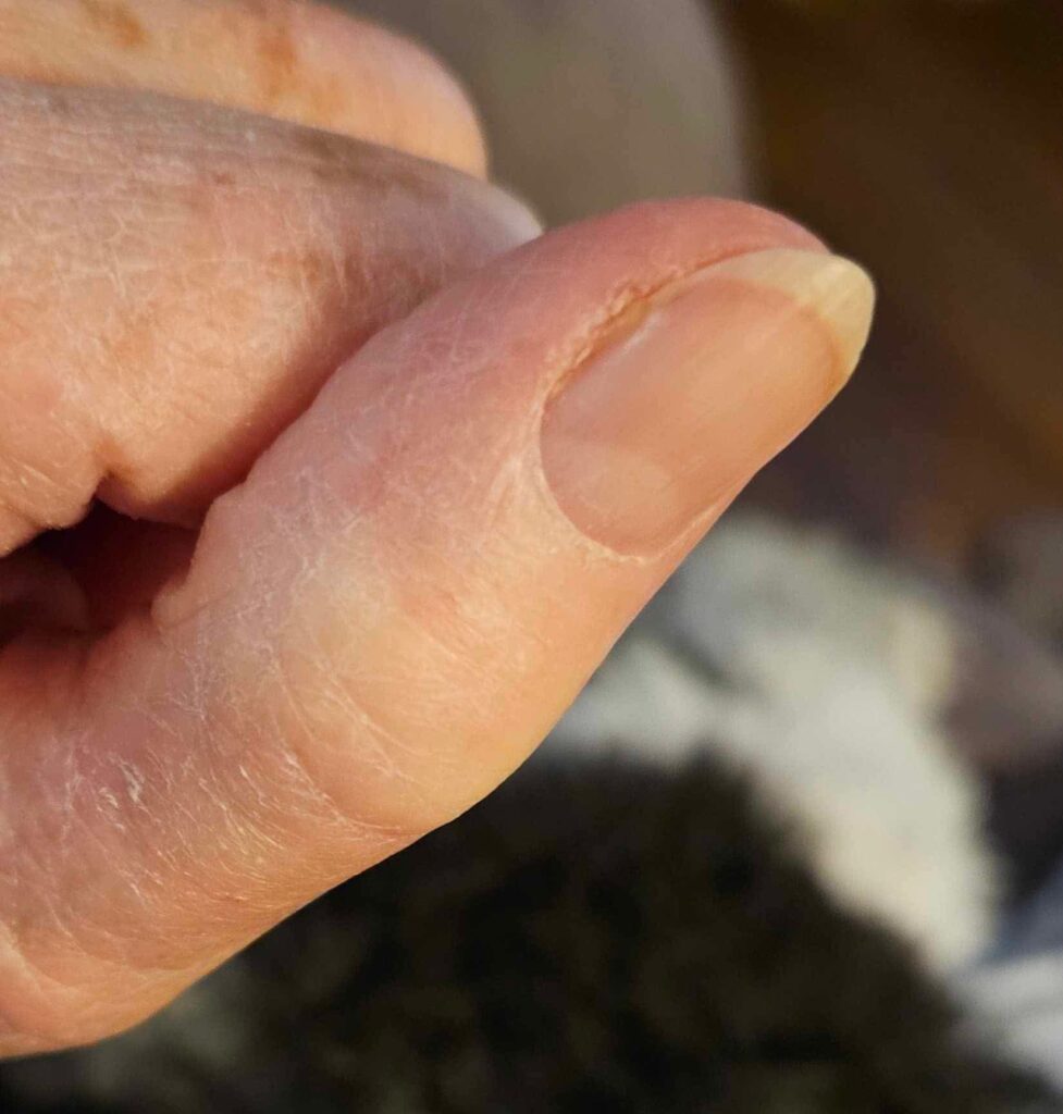 Image of the thumbnail fully recovered after Molecular Hydrogen (H₂) Targeted Sessions