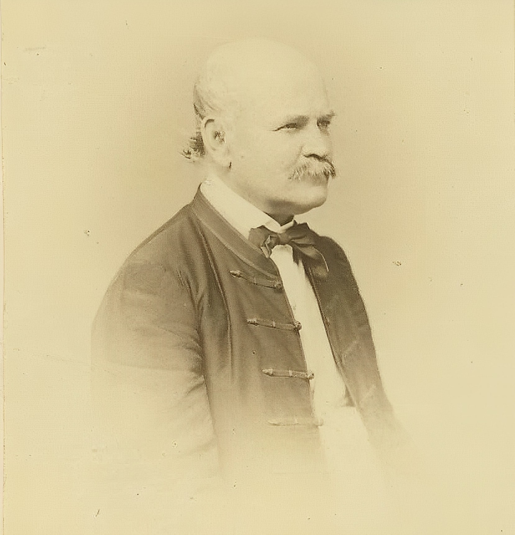 Picture of Dr. Ignaz Semmelweis, aged 42 in 1860, photograph by József Borsos / Albert Doctor